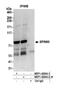 SPIN90 antibody, NBP1-42664, Novus Biologicals, Western Blot image 