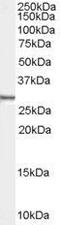 Syndecan Binding Protein antibody, GTX89228, GeneTex, Western Blot image 