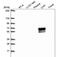 Acyl-CoA Synthetase Medium Chain Family Member 2A antibody, NBP2-46841, Novus Biologicals, Western Blot image 