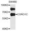 Coronin 1C antibody, STJ23202, St John