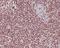 Far Upstream Element Binding Protein 1 antibody, M03126, Boster Biological Technology, Immunohistochemistry paraffin image 