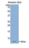 Gap Junction Protein Beta 3 antibody, LS-C293515, Lifespan Biosciences, Western Blot image 