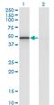 Regulator Of Calcineurin 2 antibody, MA5-24549, Invitrogen Antibodies, Western Blot image 