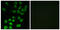 ADP Ribosylation Factor GTPase Activating Protein 1 antibody, GTX87479, GeneTex, Immunocytochemistry image 