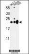 M31 antibody, MBS9203619, MyBioSource, Western Blot image 