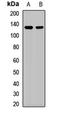 Spliceosome Associated Factor 3, U4/U6 Recycling Protein antibody, LS-C668189, Lifespan Biosciences, Western Blot image 