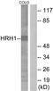 Histamine Receptor H1 antibody, LS-B9275, Lifespan Biosciences, Western Blot image 