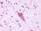 Mammary Tumor Virus Receptor antibody, PA1-23362, Invitrogen Antibodies, Immunohistochemistry frozen image 