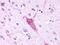 Mammary Tumor Virus Receptor antibody, PA1-23362, Invitrogen Antibodies, Immunohistochemistry frozen image 