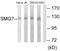 SMG7 Nonsense Mediated MRNA Decay Factor antibody, GTX87360, GeneTex, Western Blot image 