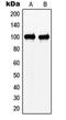 NEDD4 Binding Protein 1 antibody, orb214922, Biorbyt, Western Blot image 