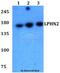 Adhesion G Protein-Coupled Receptor L2 antibody, A12163, Boster Biological Technology, Western Blot image 