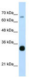 THO Complex 3 antibody, TA343953, Origene, Western Blot image 