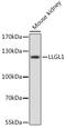 LLGL Scribble Cell Polarity Complex Component 1 antibody, A06016, Boster Biological Technology, Western Blot image 