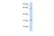 Rho GTPase Activating Protein 25 antibody, A12463, Boster Biological Technology, Western Blot image 