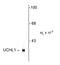 Ubiquitin C-Terminal Hydrolase L1 antibody, GTX82568, GeneTex, Western Blot image 