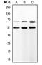 Matrix Metallopeptidase 8 antibody, MBS822204, MyBioSource, Western Blot image 