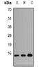 Profilin 1 antibody, abx142138, Abbexa, Western Blot image 