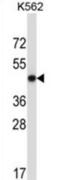 Methionyl Aminopeptidase 2 antibody, abx028022, Abbexa, Western Blot image 