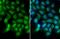 Nuclear Receptor Subfamily 3 Group C Member 1 antibody, GTX113208, GeneTex, Immunocytochemistry image 