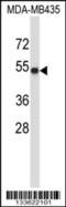 Tubulin alpha-3C/D chain antibody, 57-105, ProSci, Western Blot image 