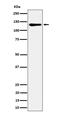 Minichromosome Maintenance Complex Component 2 antibody, M00374-2, Boster Biological Technology, Western Blot image 