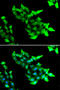KRIT1 Ankyrin Repeat Containing antibody, STJ28961, St John