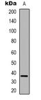 LRAT Domain Containing 2 antibody, LS-C368673, Lifespan Biosciences, Western Blot image 