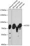 Acyl-CoA Synthetase Short Chain Family Member 3 antibody, GTX66206, GeneTex, Western Blot image 