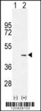 COCH antibody, 55-789, ProSci, Western Blot image 