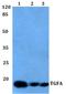 Transforming Growth Factor Alpha antibody, A01779-1, Boster Biological Technology, Western Blot image 