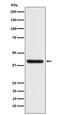 Tropomodulin-2 antibody, M12585, Boster Biological Technology, Western Blot image 