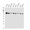 Phosphate Regulating Endopeptidase Homolog X-Linked antibody, A02078, Boster Biological Technology, Western Blot image 