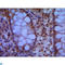 Structural Maintenance Of Chromosomes 1A antibody, LS-C813122, Lifespan Biosciences, Immunohistochemistry paraffin image 