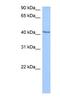 Decapping MRNA 2 antibody, NBP1-57442, Novus Biologicals, Western Blot image 