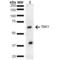 Mitogen-Activated Protein Kinase Kinase Kinase 7 antibody, LS-C775036, Lifespan Biosciences, Western Blot image 