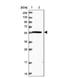 Oxysterol Binding Protein Like 2 antibody, NBP1-92236, Novus Biologicals, Western Blot image 