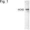 Hyperpolarization Activated Cyclic Nucleotide Gated Potassium And Sodium Channel 2 antibody, NBP2-22518, Novus Biologicals, Western Blot image 