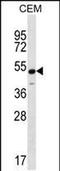 Potassium Voltage-Gated Channel Subfamily J Member 8 antibody, PA5-48354, Invitrogen Antibodies, Western Blot image 