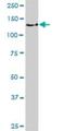 BUB1 Mitotic Checkpoint Serine/Threonine Kinase antibody, H00000699-D01P, Novus Biologicals, Western Blot image 