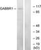 Gamma-aminobutyric acid type B receptor subunit 1 antibody, TA313902, Origene, Western Blot image 
