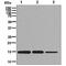 Microsomal Glutathione S-Transferase 1 antibody, ab131059, Abcam, Western Blot image 