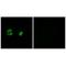 Mitochondrial Ribosomal Protein S22 antibody, A10300, Boster Biological Technology, Immunohistochemistry paraffin image 