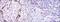 Endoglin antibody, GTX60452, GeneTex, Immunohistochemistry paraffin image 
