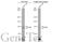 Toll Like Receptor 3 antibody, GTX113022, GeneTex, Western Blot image 