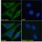 RNA 2',3'-Cyclic Phosphate And 5'-OH Ligase antibody, 42-360, ProSci, Immunohistochemistry frozen image 