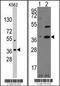 Nanog Homeobox antibody, TA302153, Origene, Western Blot image 
