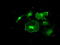 Fyn Related Src Family Tyrosine Kinase antibody, LS-C114623, Lifespan Biosciences, Immunofluorescence image 