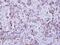 Interferon Gamma Receptor 1 antibody, PA5-27841, Invitrogen Antibodies, Immunohistochemistry paraffin image 