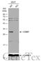 Catechol-O-Methyltransferase antibody, GTX114062, GeneTex, Western Blot image 